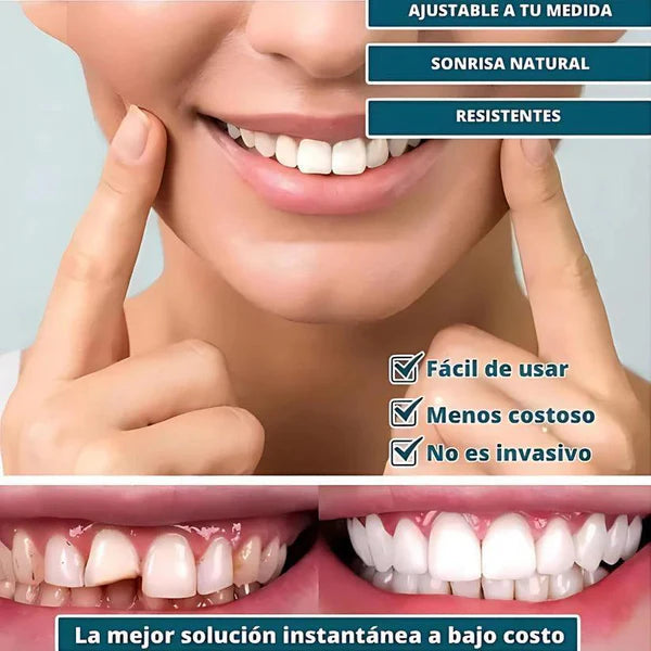 🔥50%OFF🔥SOLO HOY🔥 Smile Pro® - Carillas Dentales Removibles | Inferior y Superior