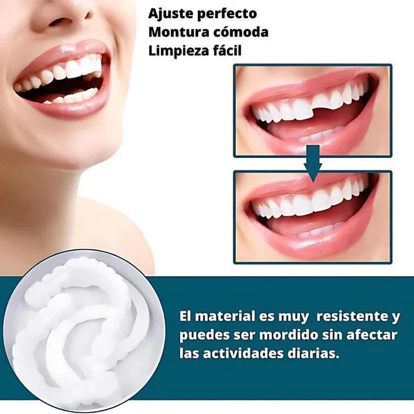 🔥50%OFF🔥SOLO HOY🔥 Smile Pro® - Carillas Dentales Removibles | Inferior y Superior