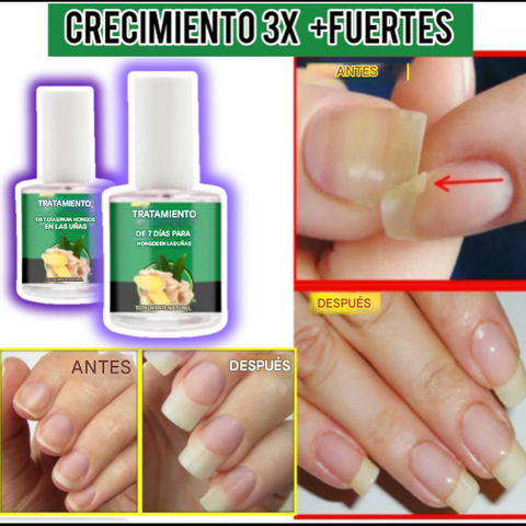 Serum Fortalecedor de Uñas X3