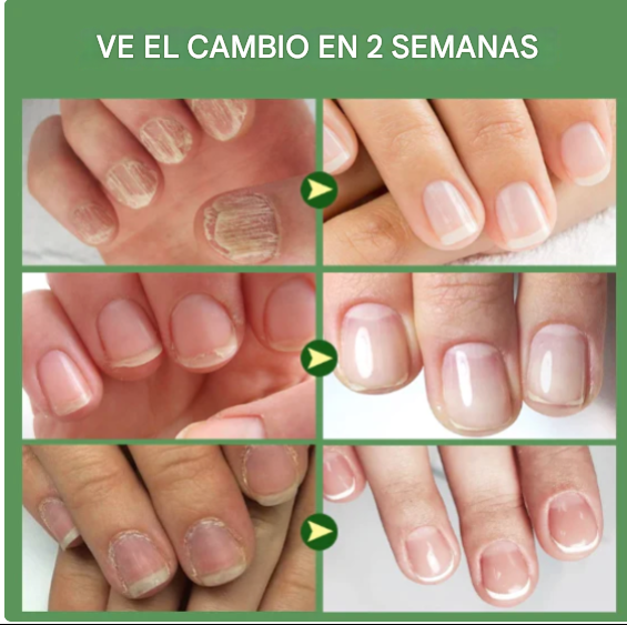 Serum Fortalecedor de Uñas