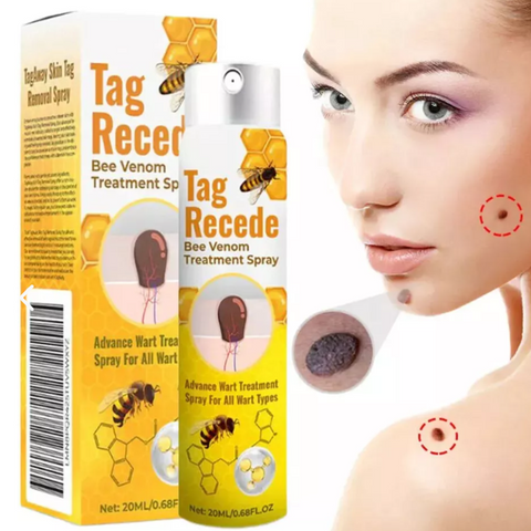 TRATAMIENTO PARA VERRUGAS Y LUNARES🐝👨‍⚕🚚 ENVIO GRATIS Y PAGA AL RECIBIR 🚚