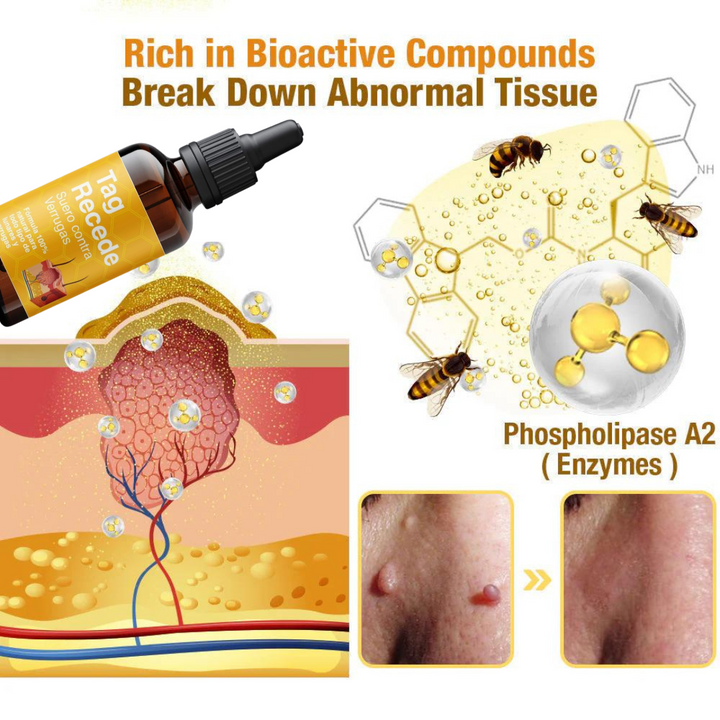 TRATAMIENTO PARA VERRUGAS Y LUNARES🐝👨‍⚕🚚 ENVIO GRATIS Y PAGA AL RECIBIR 🚚