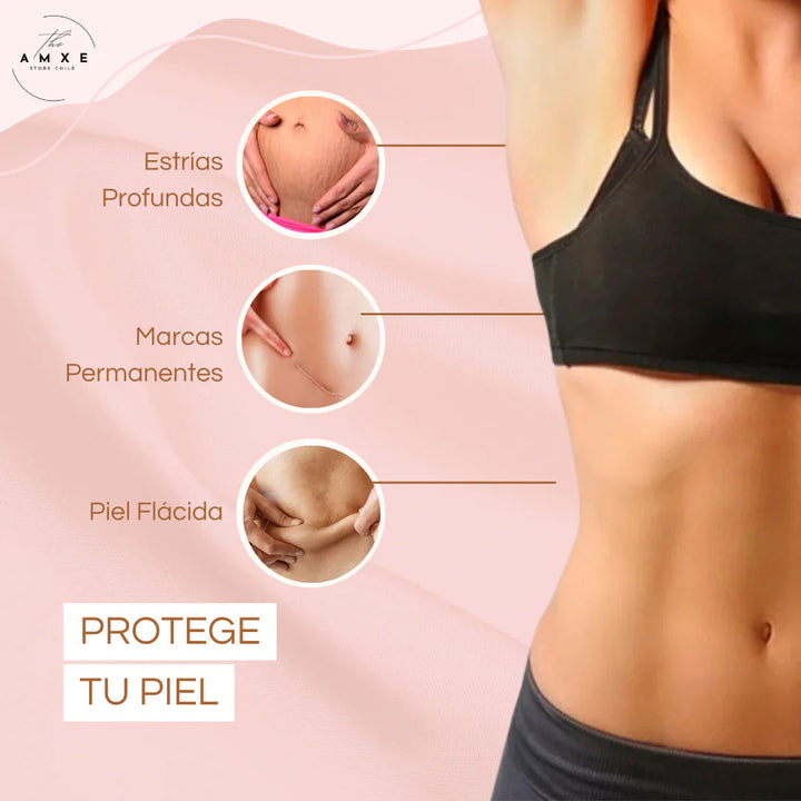 SkinRepair® 2X1 ✨  Crema Antiestrías y Anticelulitis😱 OFERTA ⚡️50% OFF ⚡️