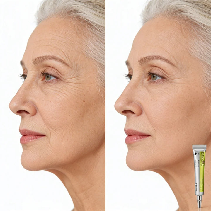 Vita A Retinal™ Firmador Shot