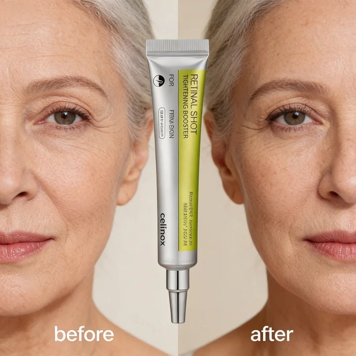 Vita A Retinal™ Firmador Shot