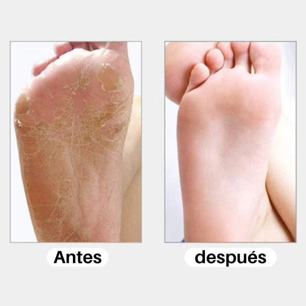 Pies Perfectos Pro 3