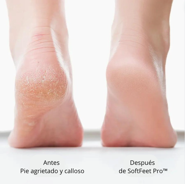 Pies Perfectos Pro 8